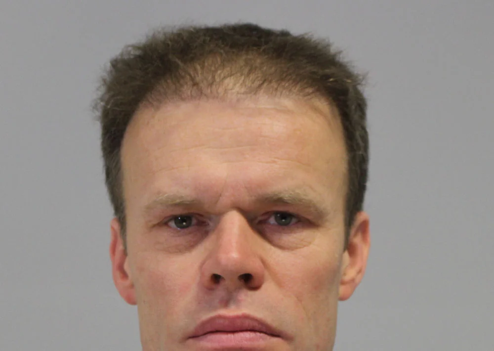 Before hair restoration: Male patient underwent a repair procedure of 1611 grafts.
